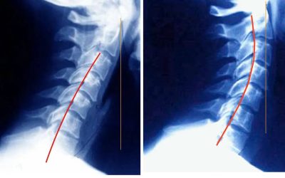 Common Questions About Chiropractic Care — Answered